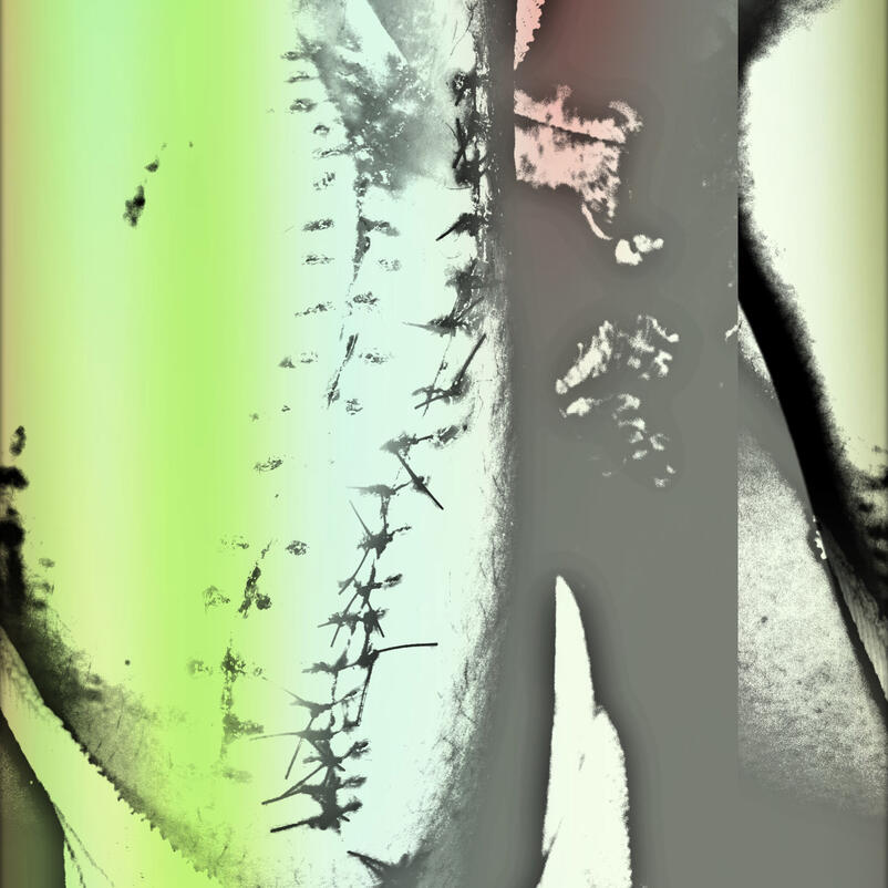 suture series