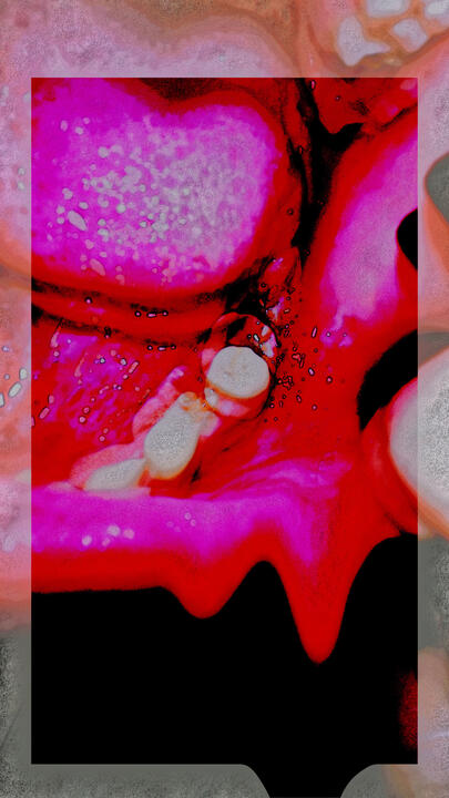 tooth lack 1 tooth lack 1